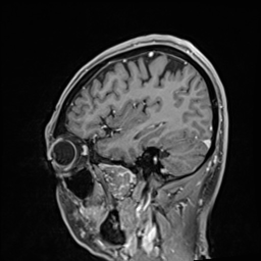 Click on the Serie image to view the images of VILLANUEVA, WILLIAM A.